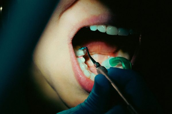 pexels-aykut-aktemur-489941105-19476290